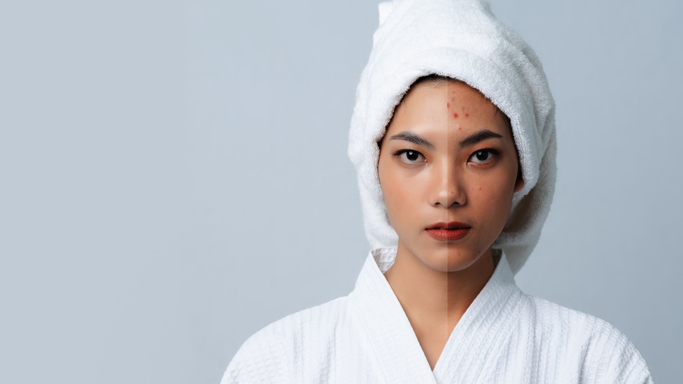 Hydroquinone For Hyperpigmentation Hydroquinone For Hyperpigmentation