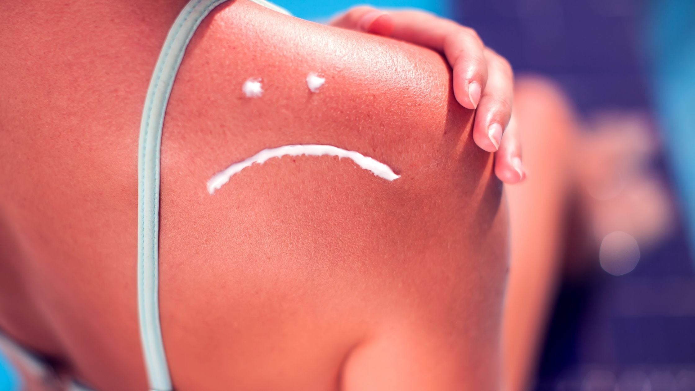 Does sunscreen expire? Does sunscreen expire?
