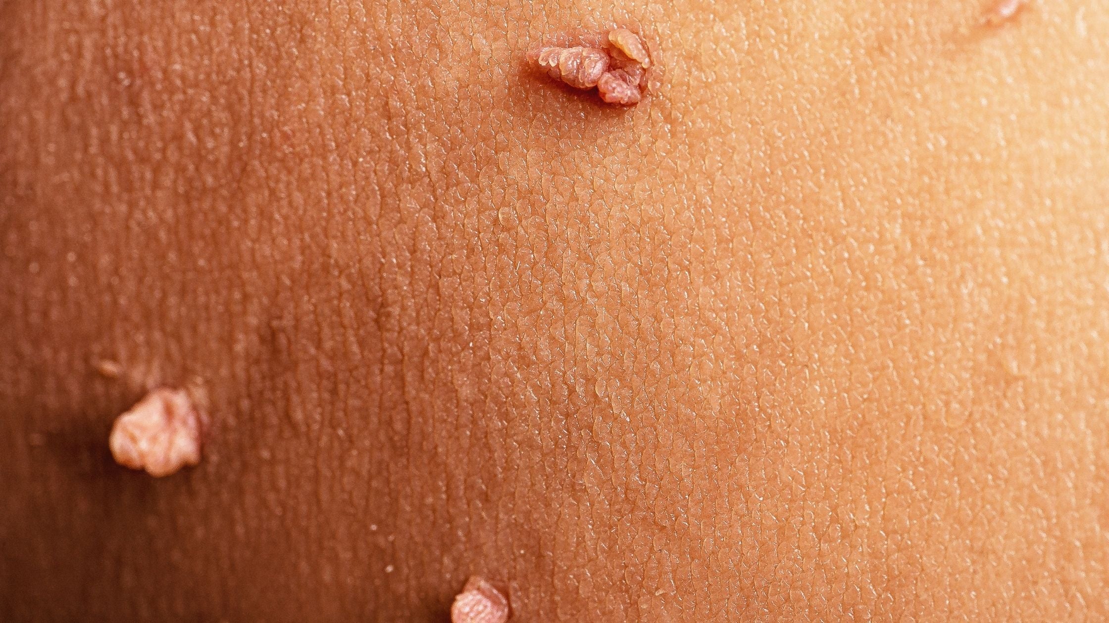 Worried about bumpy skin Worried about bumpy skin