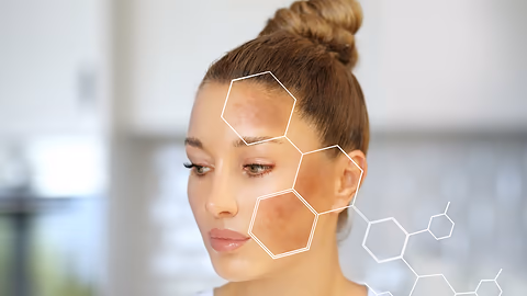 How To Reduce Melanin Production In The Skin For Clear, Spot-free Complexion