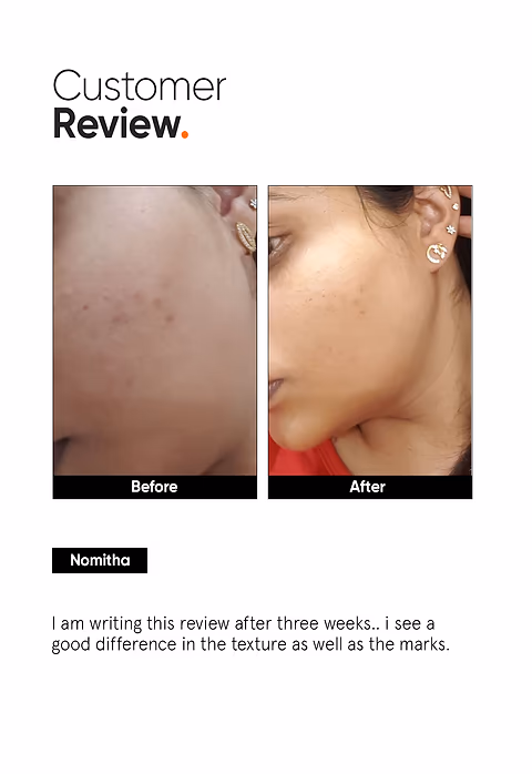 AHA PHA BHA 32% Face Peel