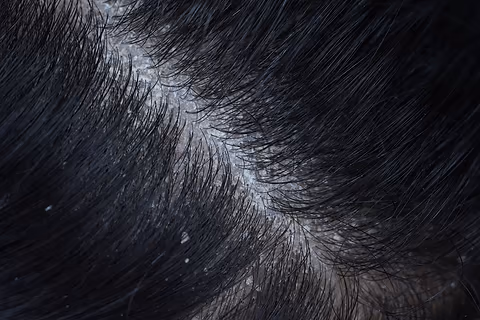 shop with Anti-Dandruff