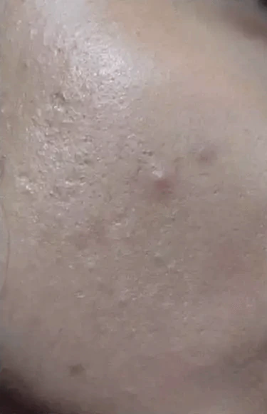 Analyze skin before Uniformness
