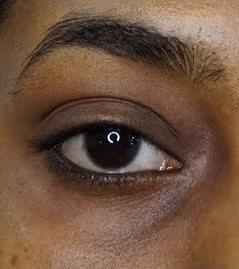 Analyze skin before Dark Circles