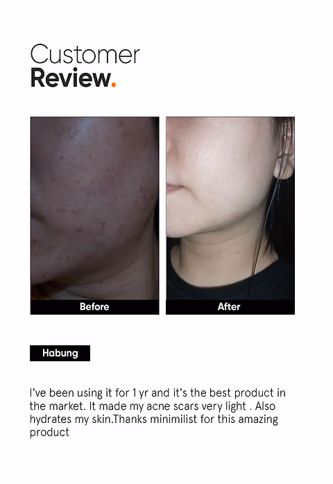 Alpha Arbutin 2% Face Serum