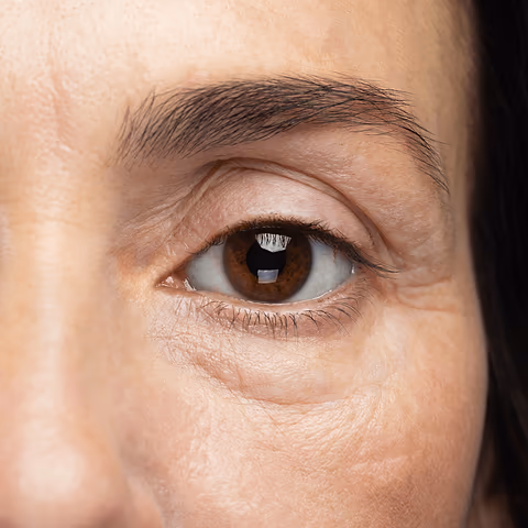 shop with Fine Lines / Wrinkles