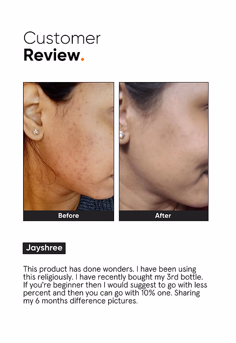 Niacinamide 10% Face Serum