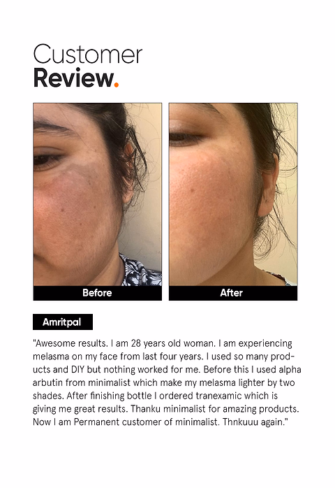 Tranexamic 3% Face Serum